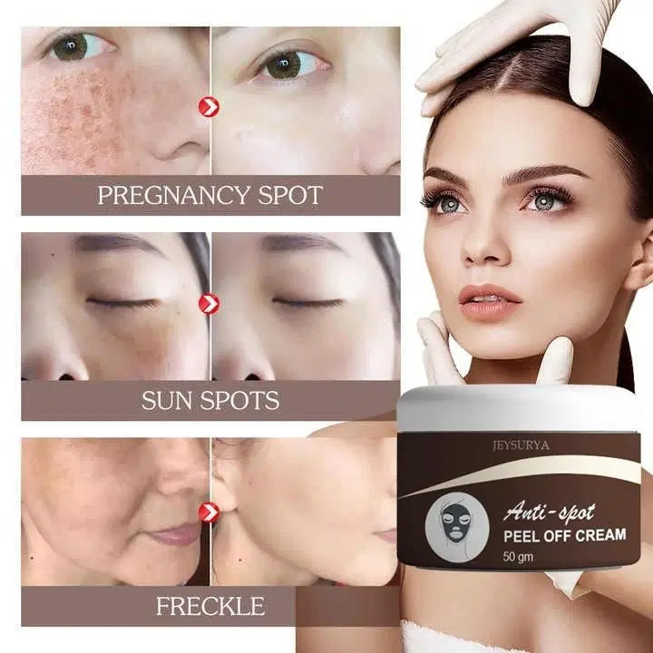 Anti-Spot Peel Off Cream by 1238 in a 50g tube, showing the cream's smooth texture and packaging for spot treatment.