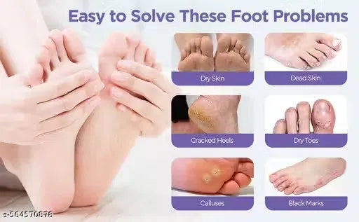 Creamy exfoliating foot mask from 19378, showing smooth, rich texture in a tube, designed for softening and renewing dry feet.