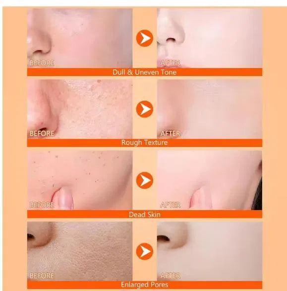 Two 400ml bottles of 18058 exfoliating kojic acid turmeric spray, showing the spray bottles with labels for skin brightening.