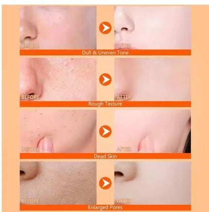Two 400ml bottles of 18058 exfoliating kojic acid turmeric spray, showing the spray bottles with labels for skin brightening.