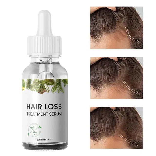 Baby hair oil serum by 16182, 30ml pack of 2, nourishing treatment for gentle hair care and hair loss prevention.