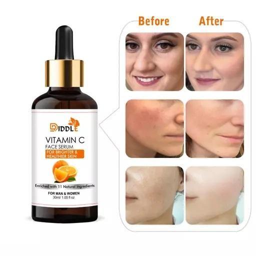 Set of three Driddle Vitamin C Face Serums by Drpshippr in sleek bottles, ideal for brightening and nourishing skin.