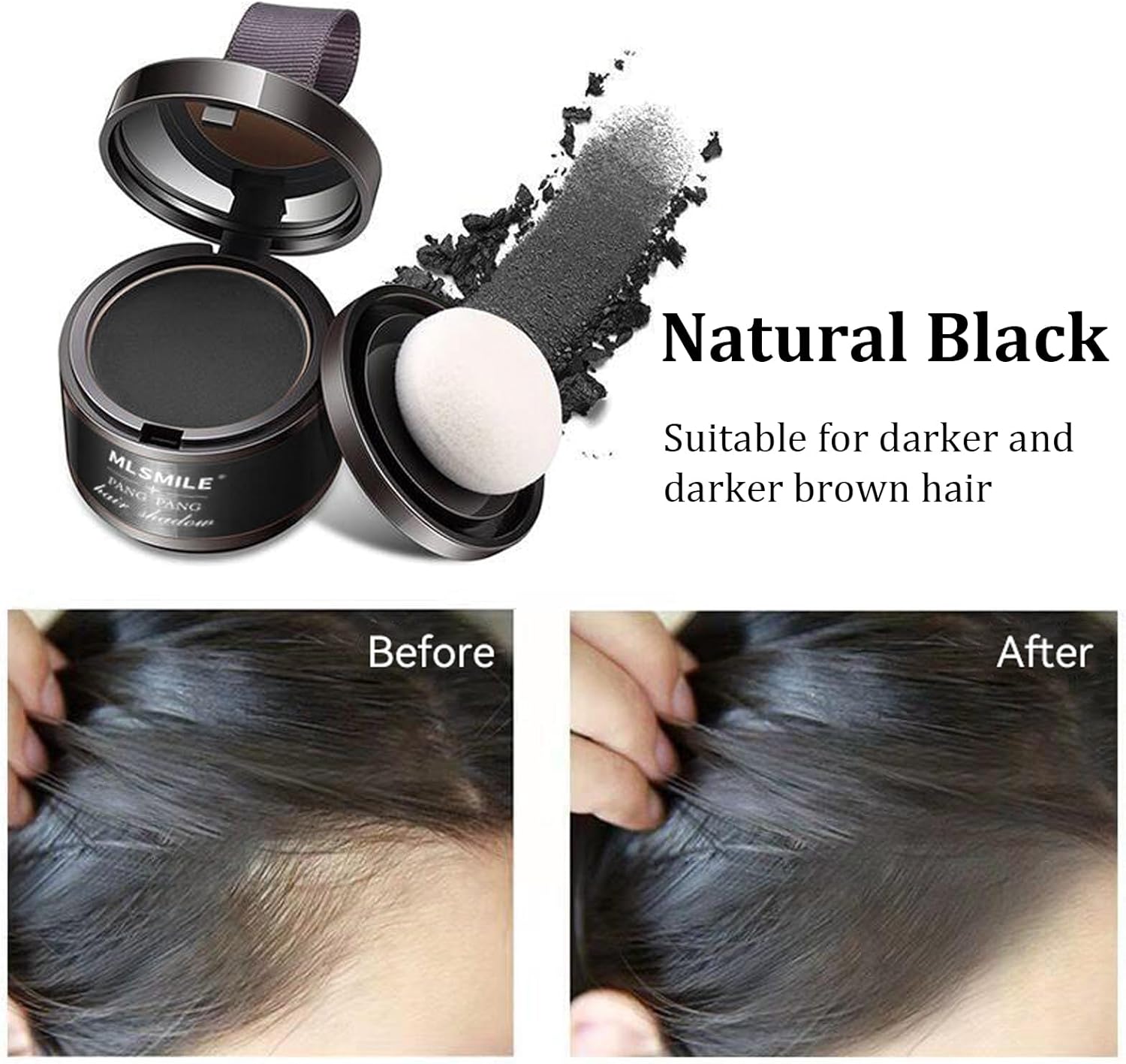 FIZZI SHOP black hair line powder applied along hairline to enhance density and define hairline natural look