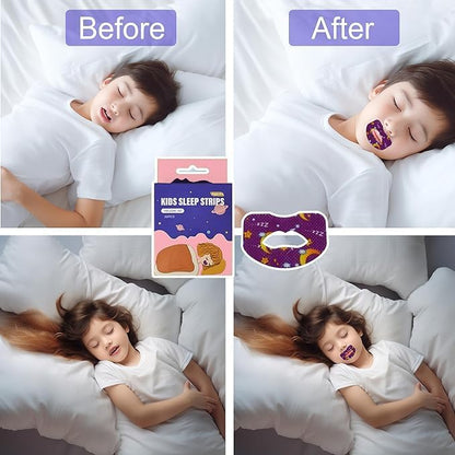 FIZZI SHOP anti snoring lips strips, 30 pcs, showing the clear adhesive strips designed to reduce snoring.