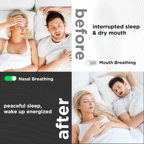 30 pcs FIZZI SHOP anti-snore mouth tape strips for mouth taping to reduce snoring and improve sleep quality.
