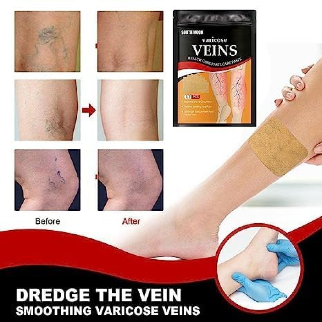 FIZZI SHOP varicose veins patches, 12-piece pack, showing adhesive patches designed to reduce discomfort and improve circulation.