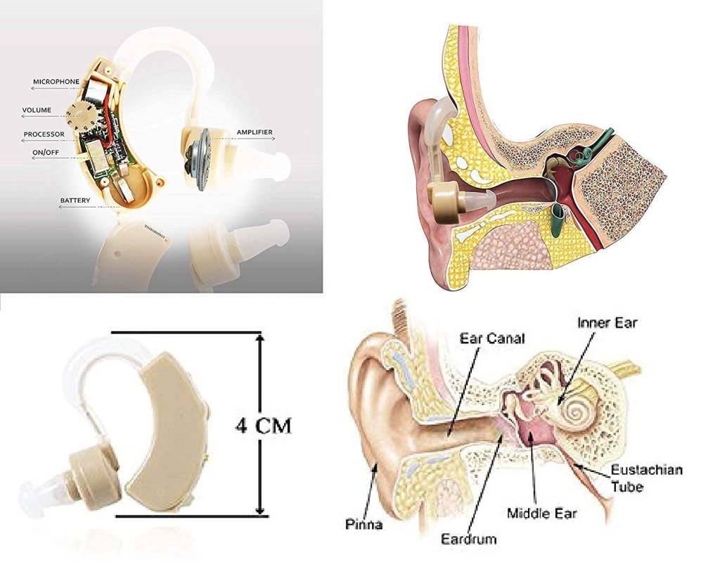 FIZZI SHOP Cyber Sonic Hearing Machine with controls and ear tips, designed for enhanced hearing assistance.