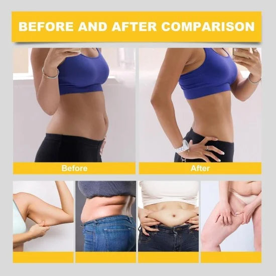 10-piece slim patches from FIZZI SHOP, showing adhesive patches designed for body slimming and contouring.