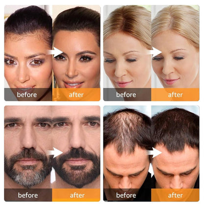 FIZZI SHOP Black Hair Line Powder applied to hairline, natural look for hairline enhancement and coverage.