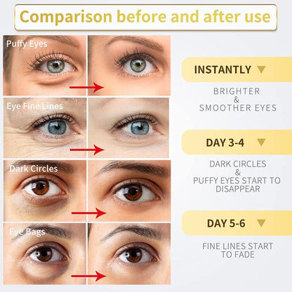 FIZZI SHOP 24K Gold Under Eye Patches shown on a model's under-eye area for hydration and brightening benefits.