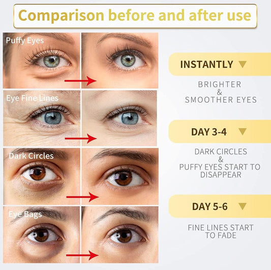 FIZZI SHOP 24K Gold Under Eye Patches shown on a model's under-eye area for hydration and brightening benefits.