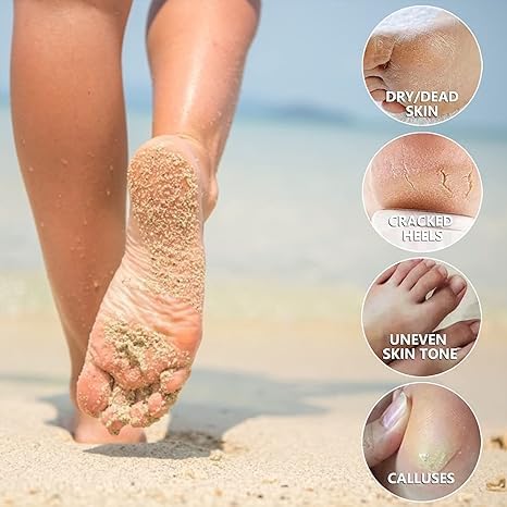 FIZZI SHOP foot peeling mask removing dead skin from feet with visible dried skin and smooth surface.