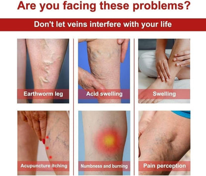 FIZZI SHOP varicose veins patches in a pack of 12, showing discreet adhesive patches for leg and vein relief.