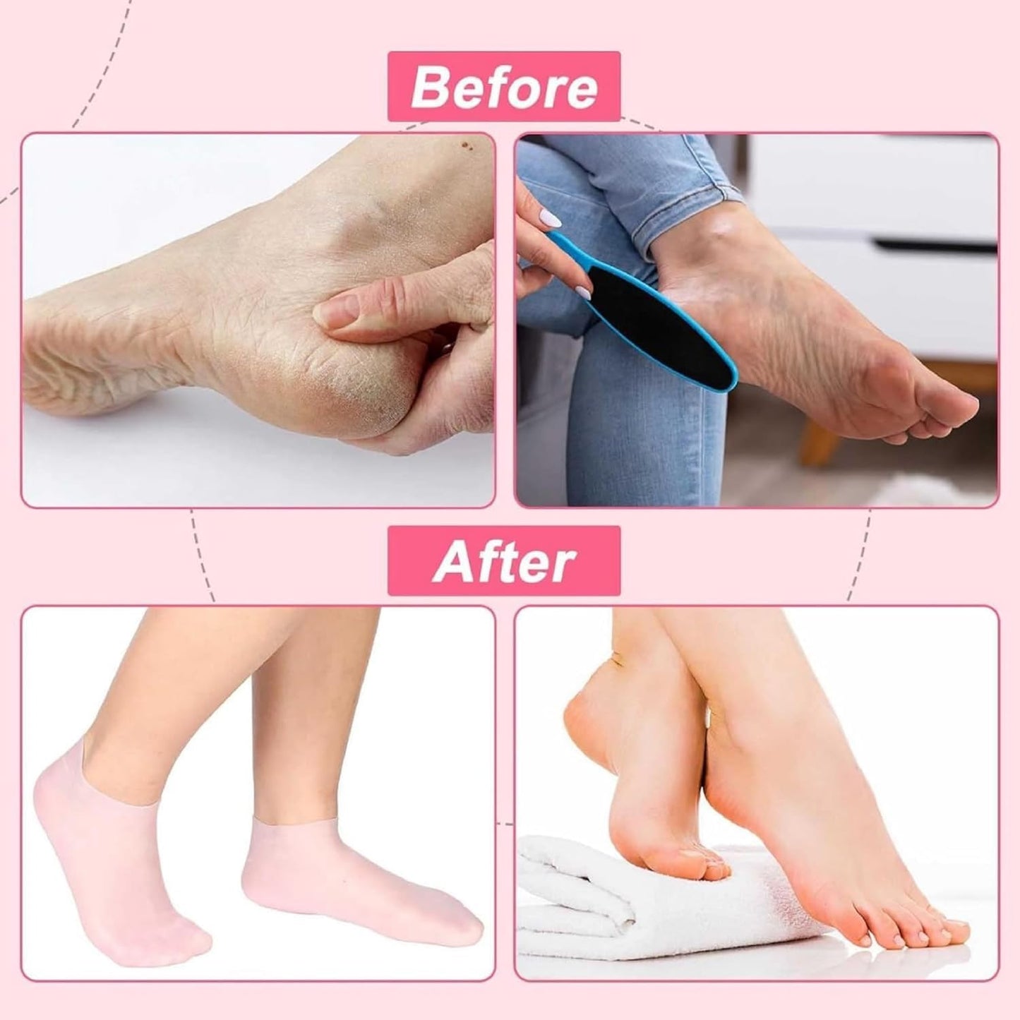 FIZZI SHOP Aloe silicone heel moisturizer socks with aloe vera for soft, hydrated heels and skin care.