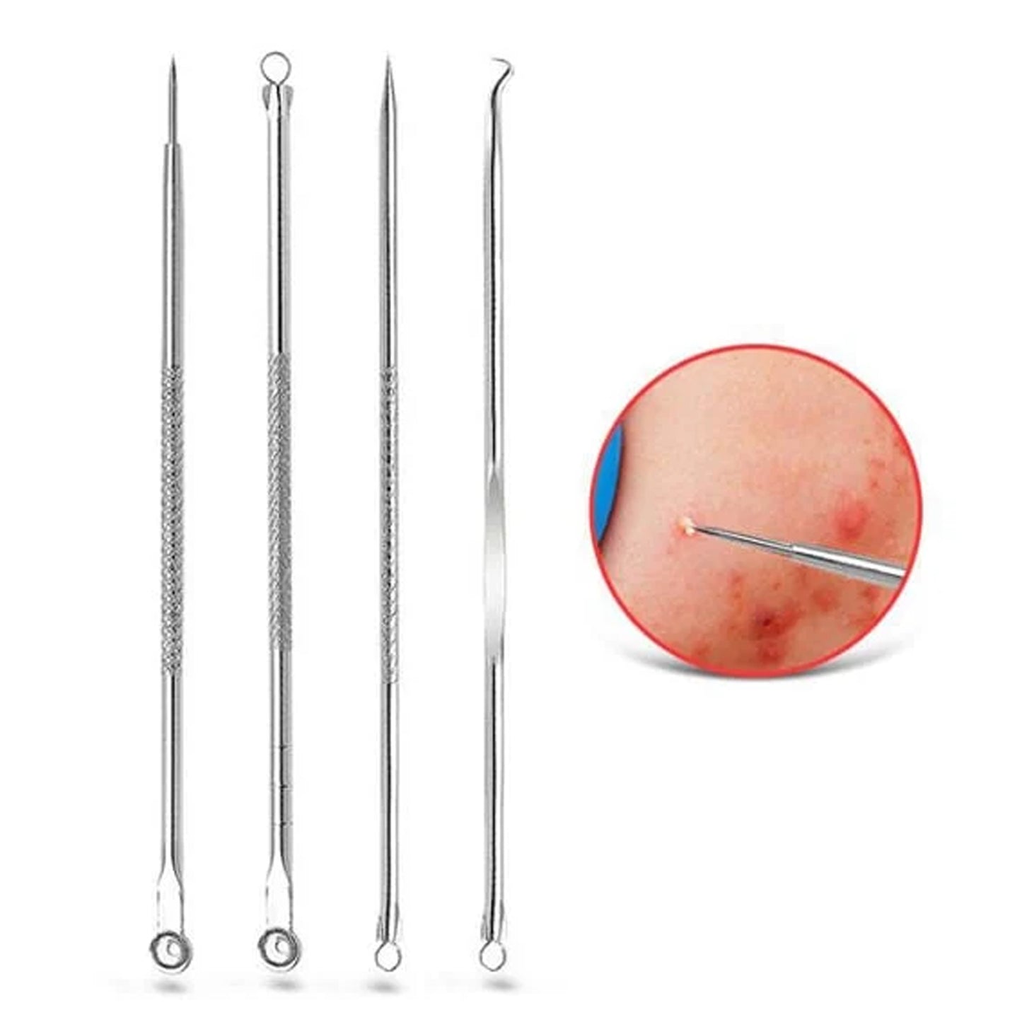 Blackhead remover 4-in-1 stainless steel pimple extractor tool by Wukusy, shown with multiple extraction heads for skincare.