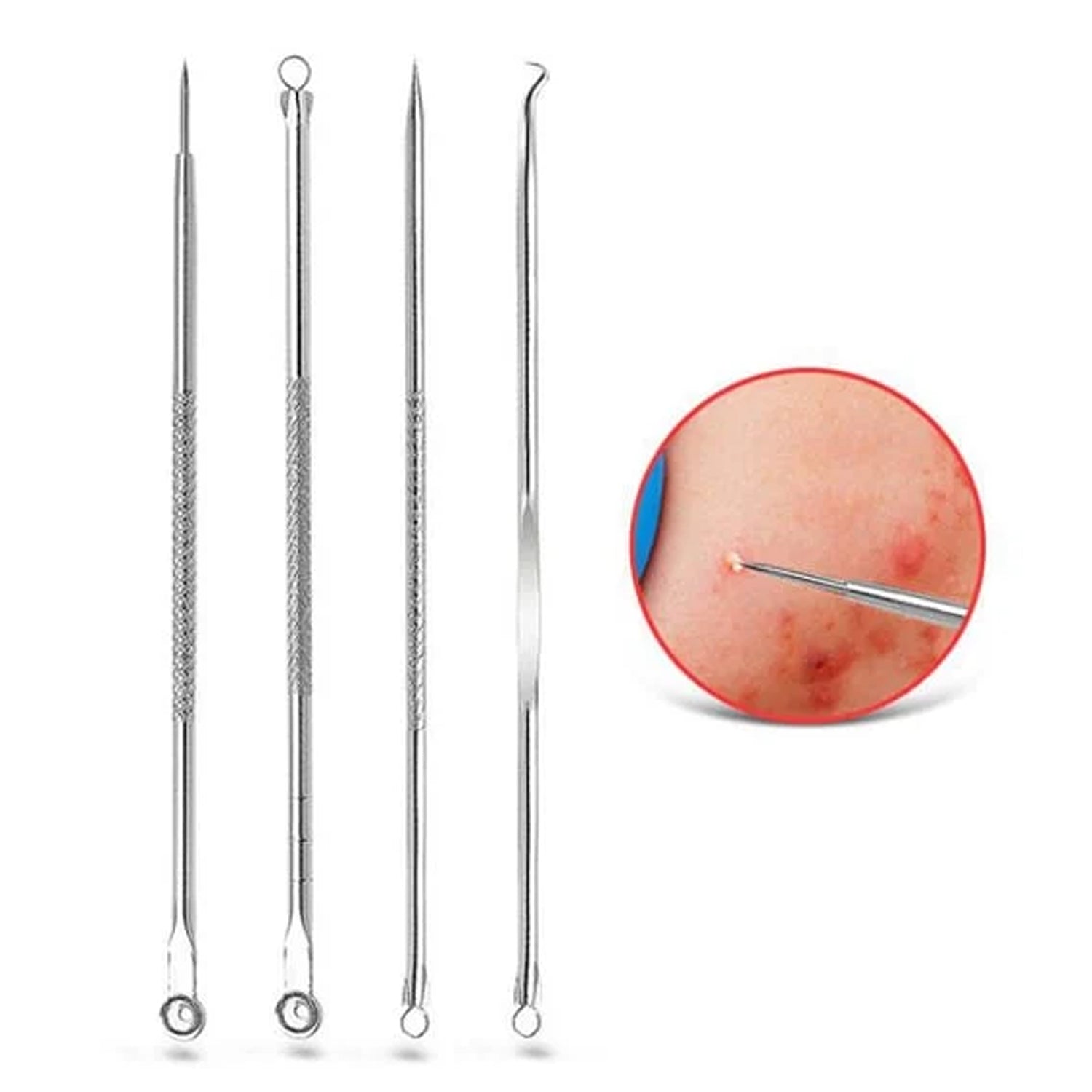 Blackhead remover 4-in-1 stainless steel pimple extractor tool by Wukusy, shown with multiple extraction heads for skincare.