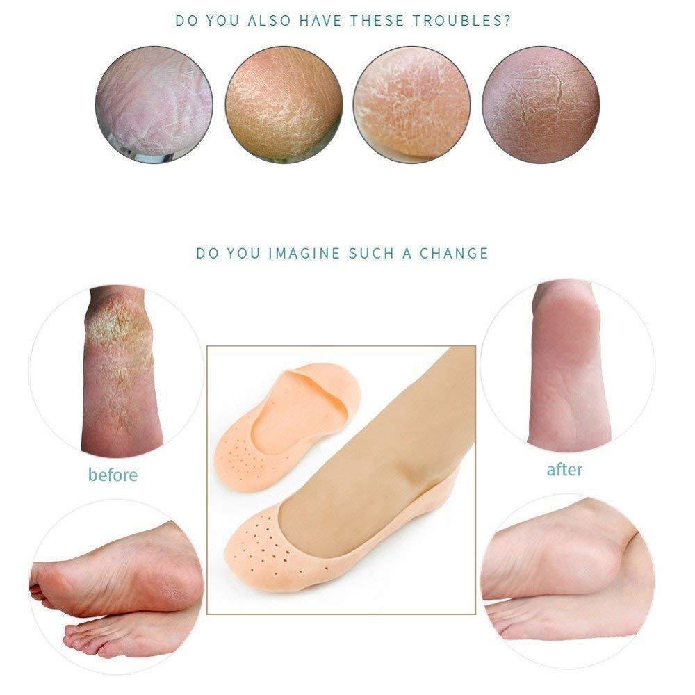 Wukusy Anti Crack Silicone Gel Foot Protector Moisturizing Socks for healthy, soft feet in health and beauty.
