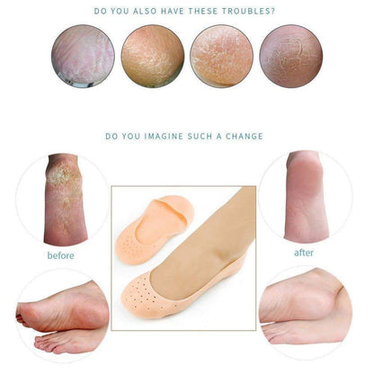 Wukusy Anti Crack Silicone Gel Foot Protector Moisturizing Socks for healthy, soft feet in health and beauty.
