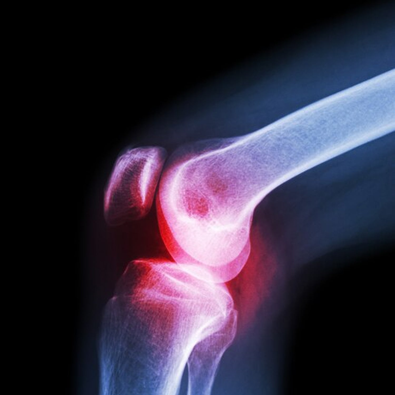 Wukusy XL knee cap for knee support, health care product, shown in black with adjustable strap and open patella design.